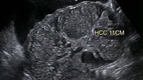 （圖／翻攝自卓韋儒醫師｜內視鏡專科・肝膽胃腸臉書）