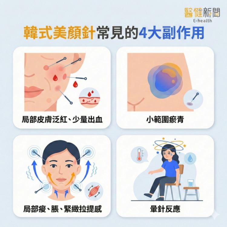 韓式美顏針愛美新選擇？ 韓式美顏針常見4大副作用！（圖／醫健新聞網提供）