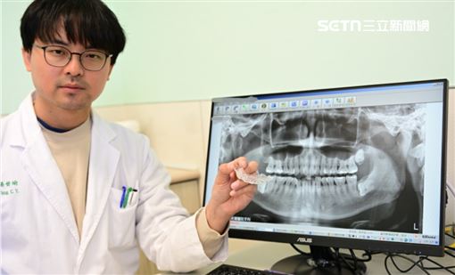 牙齒變長以為老了？竟是磨牙惹禍