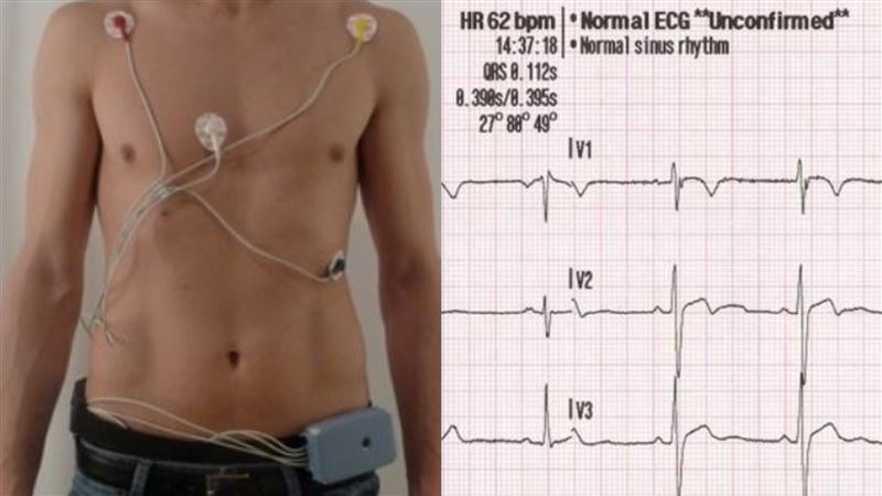 明明胸悶心慌，為何心電圖總是顯示正常？