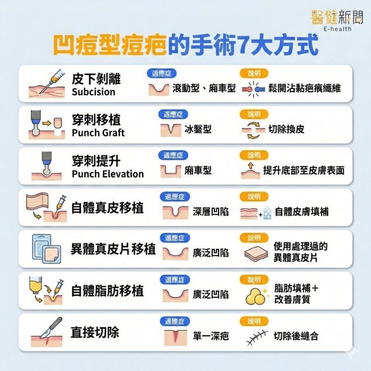 滿臉「痘」花好焦慮！凹痘型痘疤的手術7大方式。（圖／醫健新聞網提供）