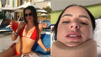 22歲正妹遭追撞　「鯊魚夾」險成致命關鍵