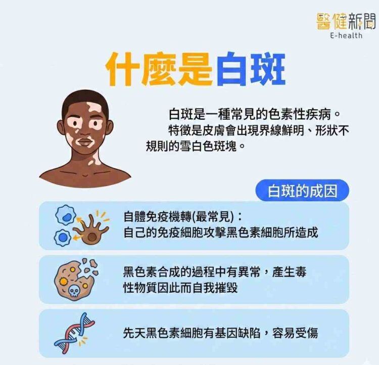 皮膚長白斑無藥可醫？什麼是白斑？如何停止擴散？治療方式一次看清！（圖／醫健新聞網提供）