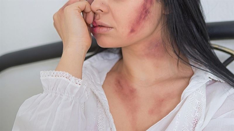 男子把前妻打到昏厥瀕死仍不送醫，卻把人再去清洗血跡滅證後，再把人丟包路邊，導致人死亡。（示意圖／PIXABAY）