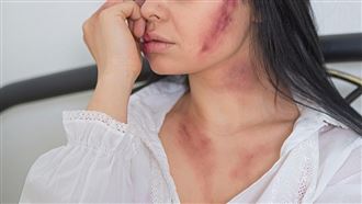 拿狗屎抹妻臉！家暴尪漠視保護令…下場曝