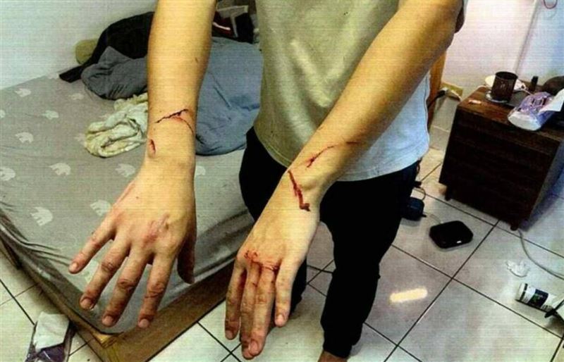 李男雙手被黑貓抓的痕跡。（圖／新北動保處提供）