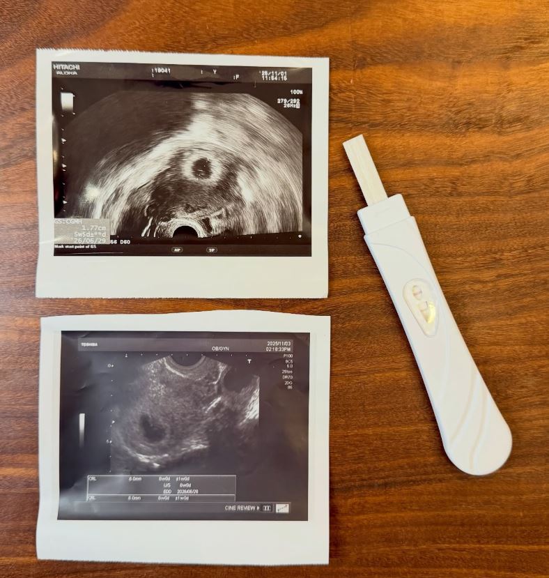 金老佛爺曬出超音波照。（圖／翻攝自IG @kimlafayette）