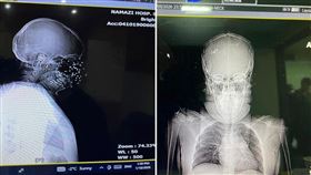 網友貼出一名女性示威者受安全部隊霰彈槍攻擊後的慘況。（圖／翻攝自X平台 @BabakTaghvaee）