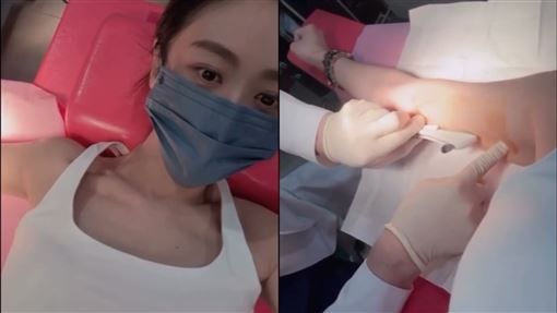女星手臂植入避孕針　全程親自掌鏡畫面曝