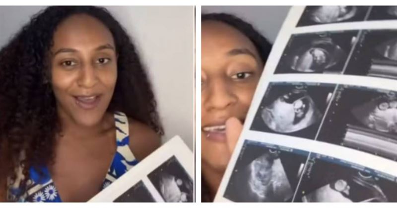 凱瑟琳妮可拉拉莫斯桑托斯（Kathleen Nicole Ramos Santos）在懷第二胎期間，罕見出現「懷孕中再度受孕」的超孕現象。（圖／翻攝自IG，Reprodu&ccedil;&atilde;o）