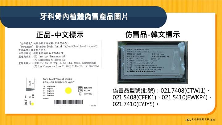 植牙爆造假！仿冒品流市面 食藥署曝4批號