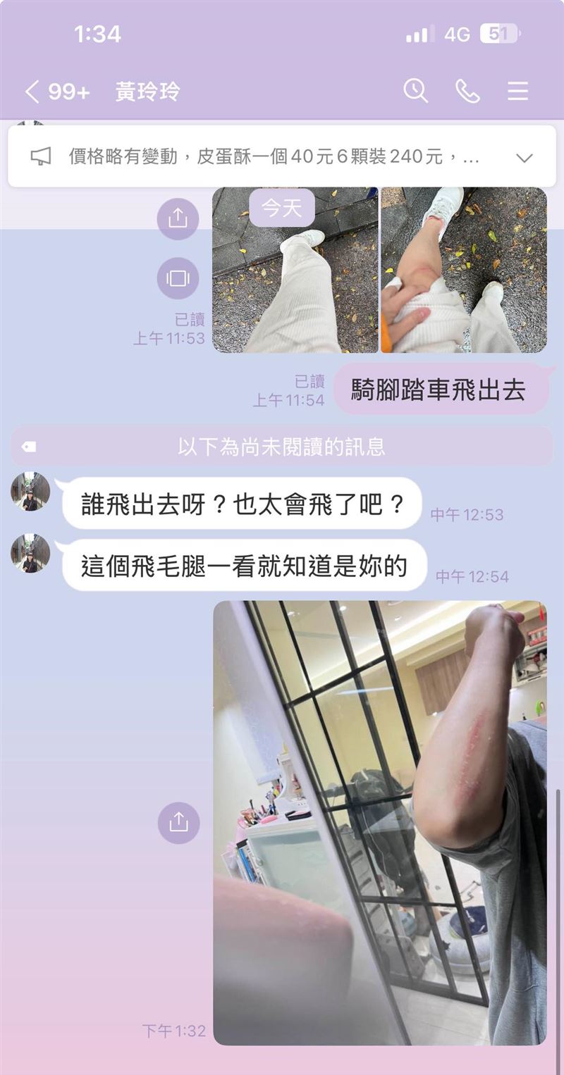 米可白表示今天騎腳踏車竟然摔飛。（圖／翻攝自臉書）