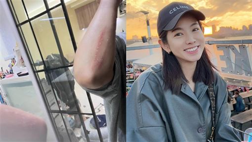 米可白驚傳車禍「整個人飛出去」傷勢曝光