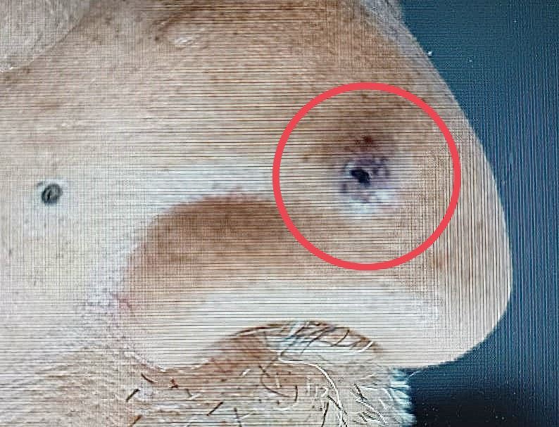 老翁鼻子上長出黑點，起初以為是痣，沒想到竟是罹患皮膚癌。(圖／光田醫院提供)