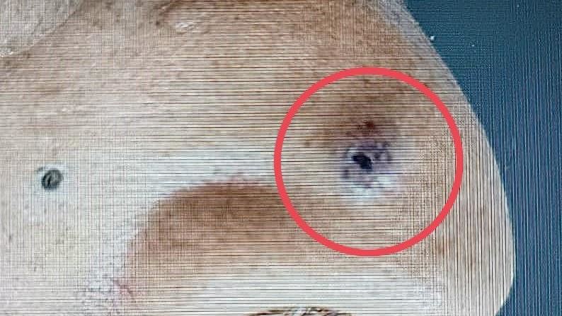 鼻子長黑點以為是痣！70歲翁拖2年竟變癌