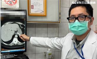 婦無甜不歡變油包心　切223克油肝像蘋果