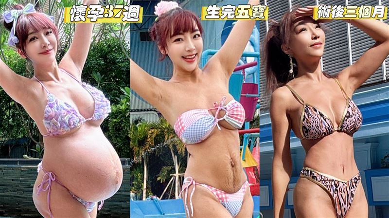 李宓分享手術過程。（圖／翻攝自臉書）