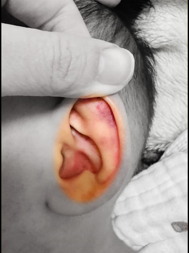 連耳朵都有傷勢。（圖／家屬授權提供）