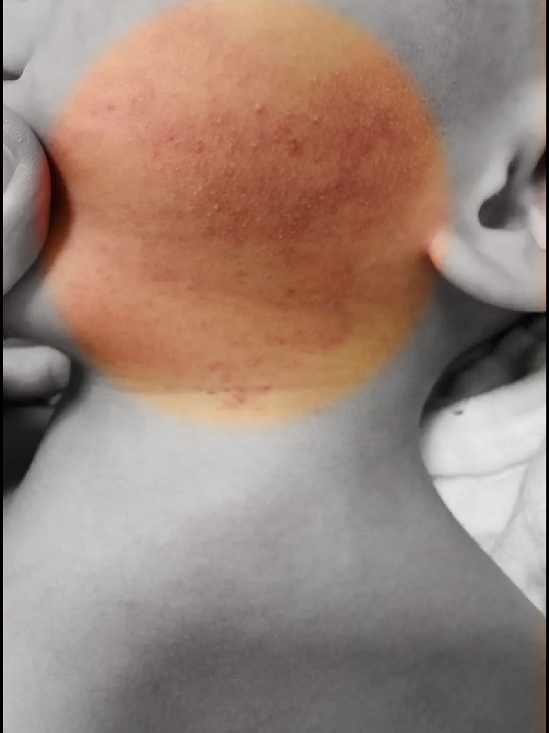 家屬PO出男童被虐打受傷的照片。（圖／家屬授權提供）