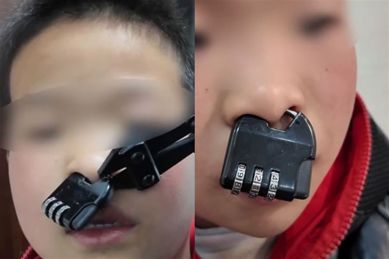 1名中國男童在玩耍時突發奇想，將手中的密碼鎖環套在鼻中膈上拆不下來，母親趕緊找消防員求救。（圖／翻攝畫面）
