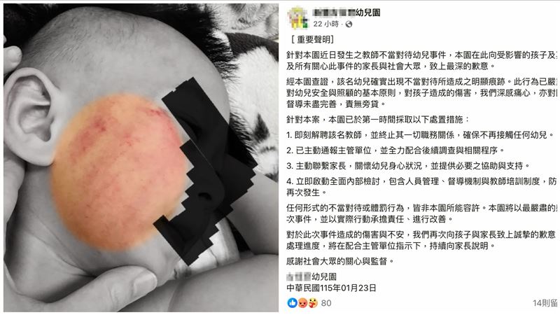 竹縣私幼師虐打2歲童1小時 幼兒園承認了
