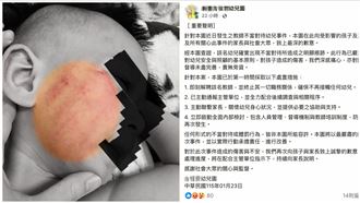 竹縣私幼師虐打2歲童1小時　幼兒園承認了