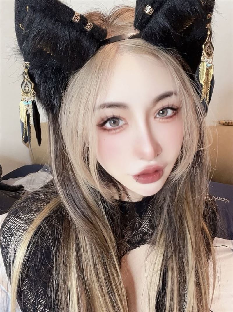 雪碧分享自己整形過程。(圖/翻攝自雪碧IG)