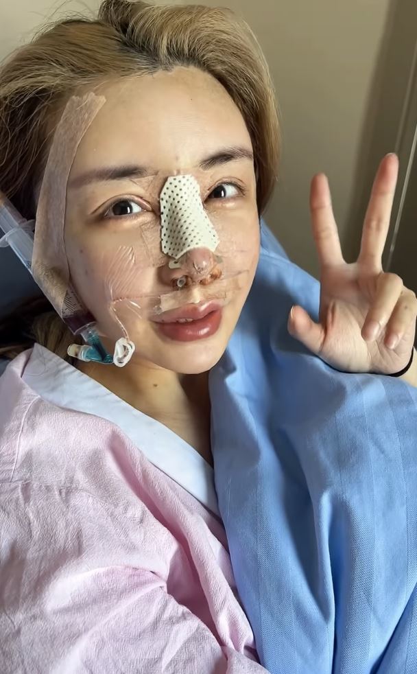 雪碧分享自己整形過程。(圖/翻攝自雪碧IG)