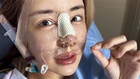 雪碧分享自己整形過程。（圖／翻攝自雪碧IG）