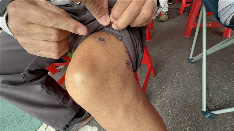 疫苗預約相當熱門，一名罹患帶狀疱疹的長者，忍痛也來排隊。(圖／翻攝畫面)