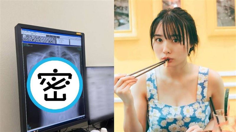 女星曬胸部健檢X光　萬人朝聖：看過最美