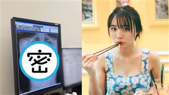 女星曬胸部健檢X光　萬人朝聖：看過最美