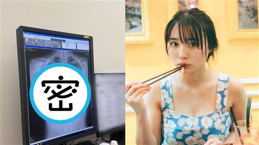 女星曬胸部健檢X光　萬人朝聖：看過最美
