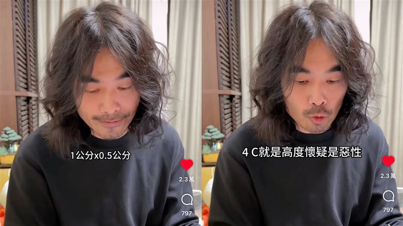 DK老婆Di掃的乳房超音波報告顯示，有一個疑似1X0.5公分腫塊，惡性的機率高達50%-95%。（圖／翻攝自異色檔案IG）