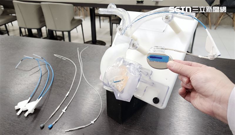 奇美醫院,台南,心臟,醫師,節律器,心搏,手術（圖／奇美醫院提供）