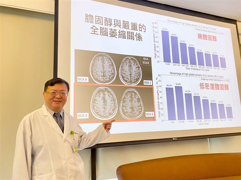 研究指出，在高齡族群中，膽固醇「過低」或「短期內劇烈下降」，反而可能增加失智症發生與惡化風險，顛覆過往「膽固醇越低越好」的單一思維。（圖／記者蕭麗鳳攝、醫健新聞網提供）