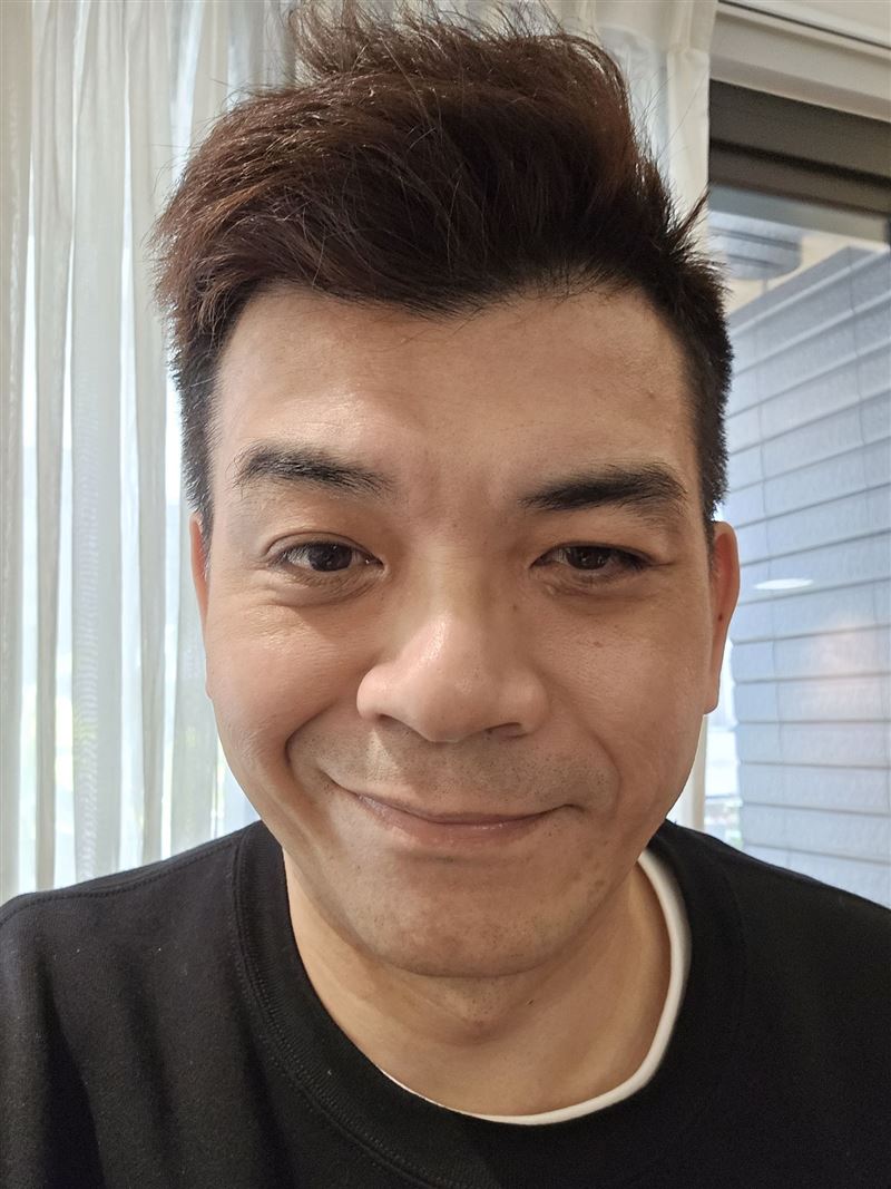 史丹利曝半邊臉無力。(圖/翻攝自熱血史丹利大叔應援團臉書)