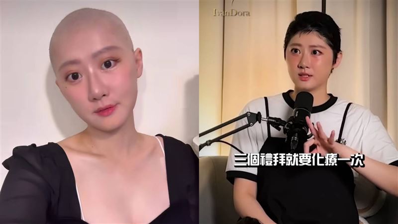 女星罹癌收入銳減 剃髮化療煎熬過程曝光