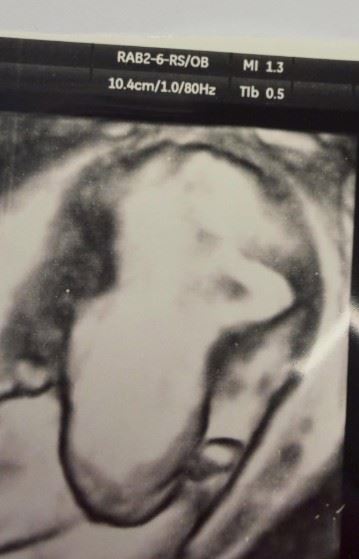 張晏塵幽默形容，肚中寶寶相當活潑，動作頻頻。（圖／翻攝自張晏塵IG）