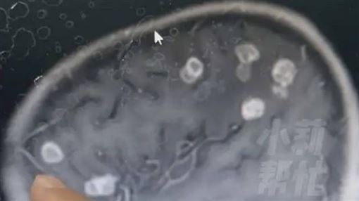 童大掃除燒17天「腦被啃出20個洞」元兇曝