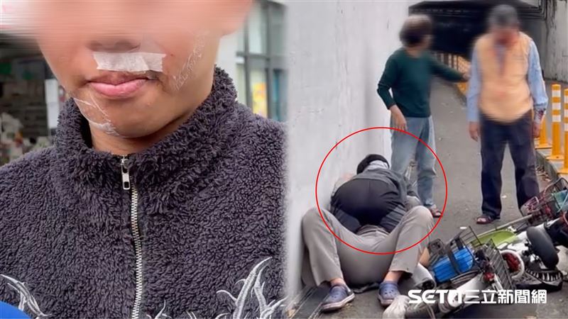 撞夫妻…男大生英勇肉搏留疤:不敢脫口罩