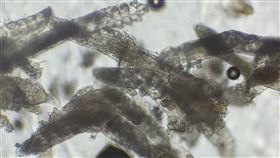 女大生臉藏數百隻蠕形蟎蟲。（圖／王佑鑫醫師授權提供，未經同意請勿轉載）