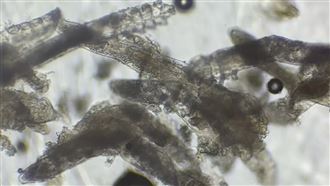 女臉藏「百隻8腳蟲」猛生孩　恐怖畫面曝