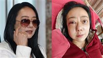 高慧君暈倒「臉部3處骨折」震撼畫面曝光