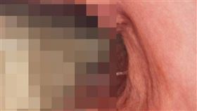 患者因上腹嚴重脹痛就醫，即使已空腹12小時，胃鏡檢查時仍發現胃與十二指腸內殘留大量食物。（圖／翻攝自臉書，吃病）