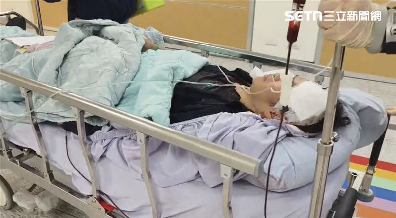 員警到院後經電腦斷層掃描確認有局部顱骨骨裂。為確保安全，目前已緊急縫合並送入加護病房（ICU）觀察。（圖／翻攝畫面）