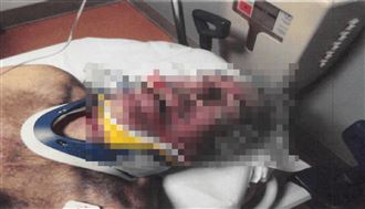 甲狀軟骨全斷裂　美解密自縊現場關鍵照