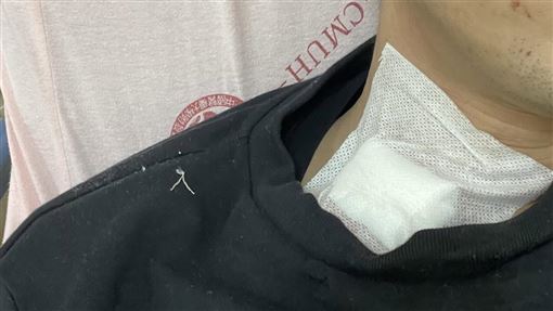 吃蒸餃無故被刺脖濺血　50歲男行兇動機曝