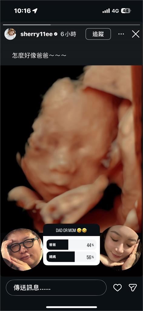 依依曬出超音波照。（圖／翻攝自IG）