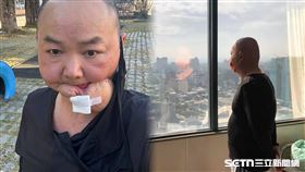 大廚罹口腔癌遭小朋友嘲笑／受訪者授權提供